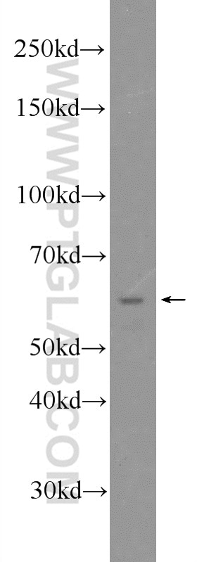 WB analysis of mouse testis using 24657-1-AP