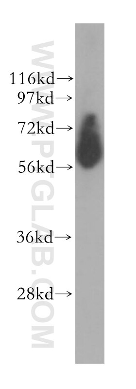 Western Blot (WB) analysis of human heart tissue using EHD2 Polyclonal antibody (11440-1-AP)