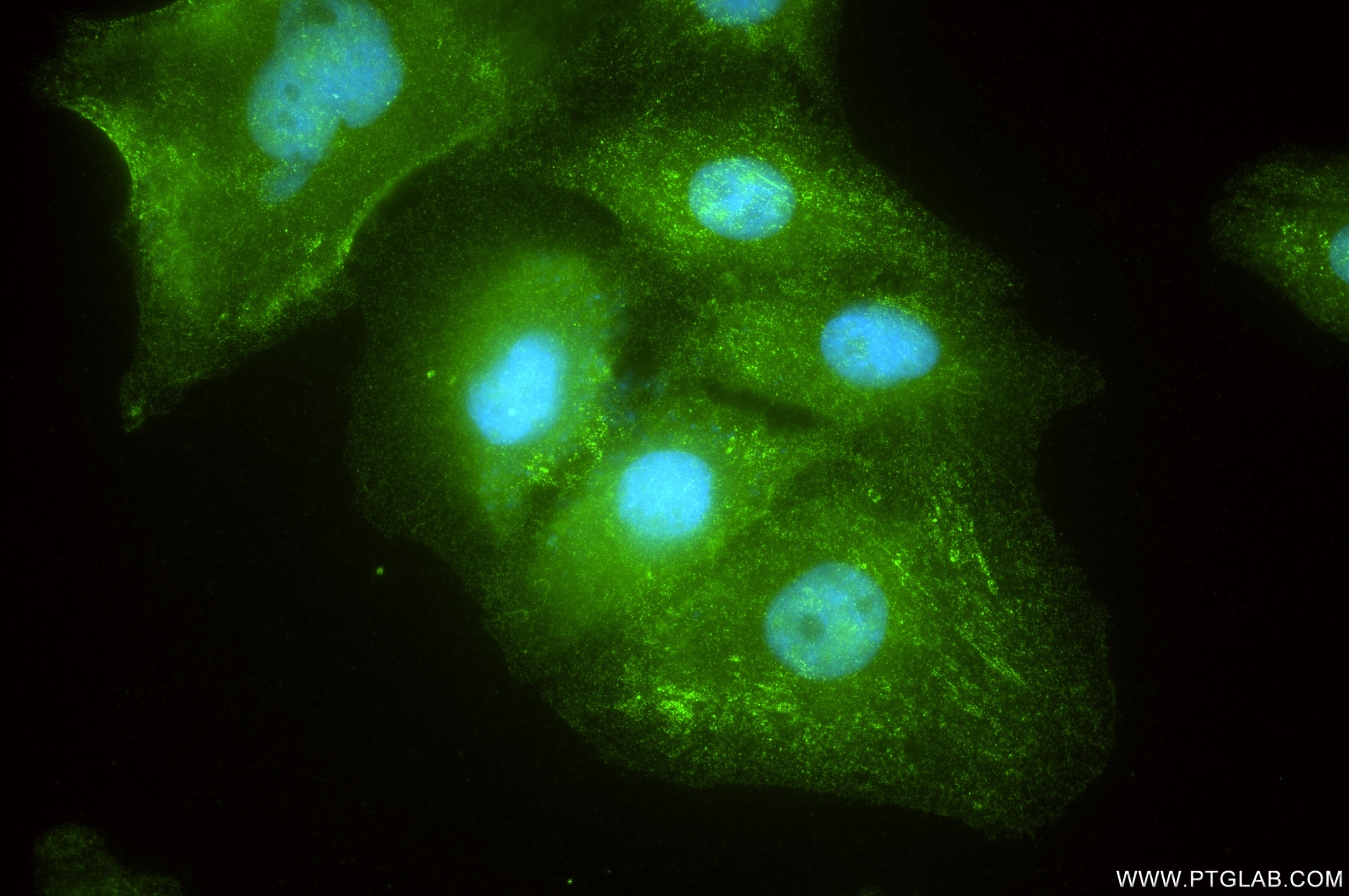 Immunofluorescence (IF) / fluorescent staining of A549 cells using EHD2 Recombinant monoclonal antibody (85604-4-RR)
