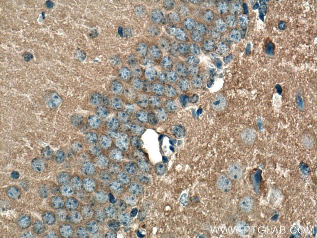 Immunohistochemistry (IHC) staining of mouse brain tissue using EHD3 Polyclonal antibody (25320-1-AP)