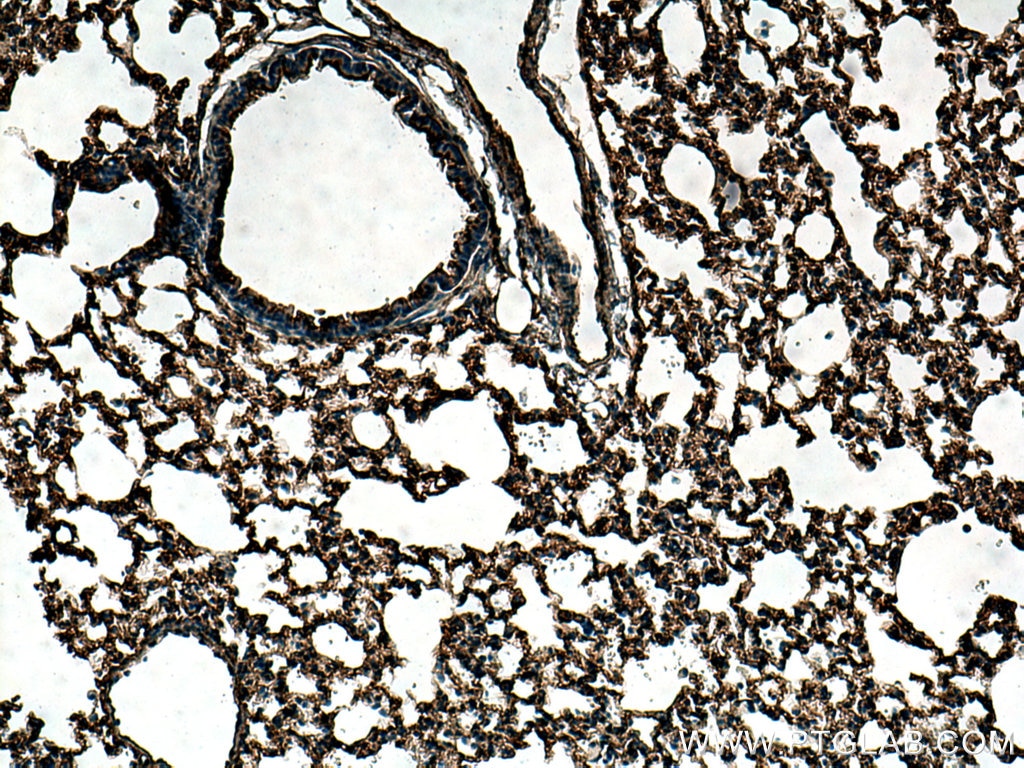 Immunohistochemistry (IHC) staining of mouse lung tissue using EHD3 Polyclonal antibody (25320-1-AP)