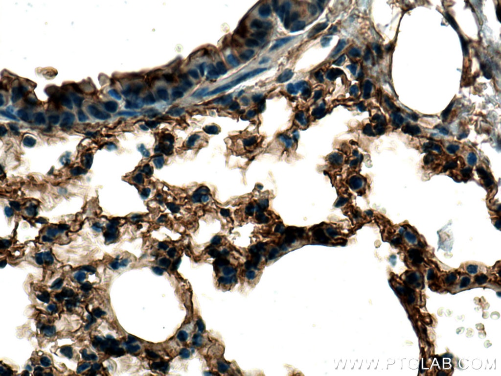 Immunohistochemistry (IHC) staining of mouse lung tissue using EHD3 Polyclonal antibody (25320-1-AP)