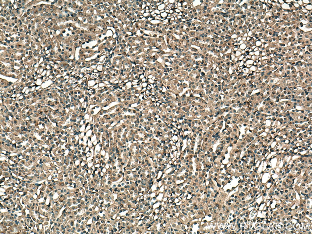 Immunohistochemistry (IHC) staining of mouse kidney tissue using EHD3 Polyclonal antibody (25320-1-AP)