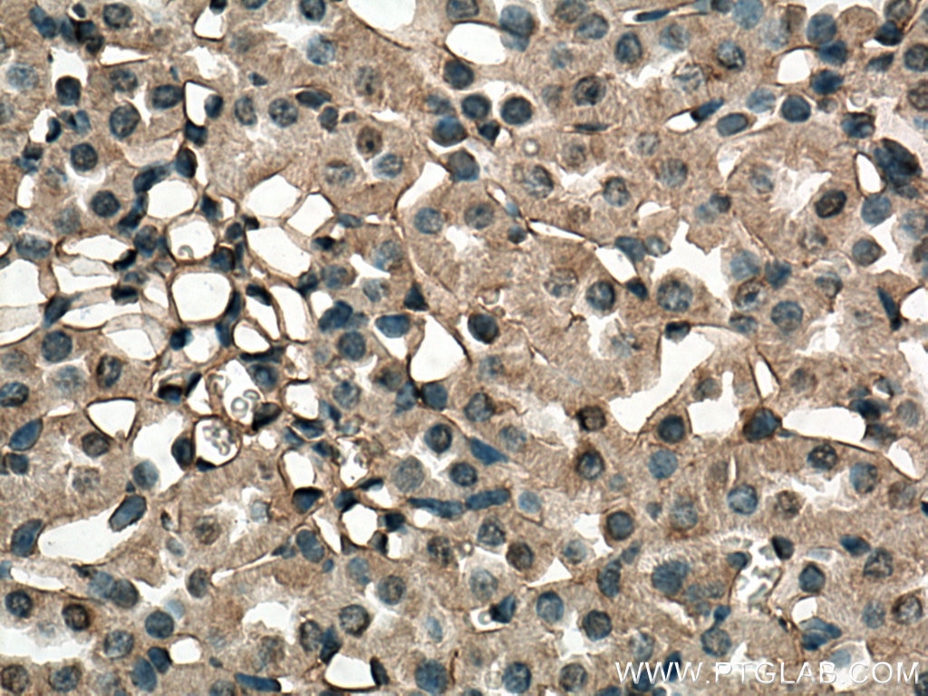 Immunohistochemistry (IHC) staining of mouse kidney tissue using EHD3 Polyclonal antibody (25320-1-AP)