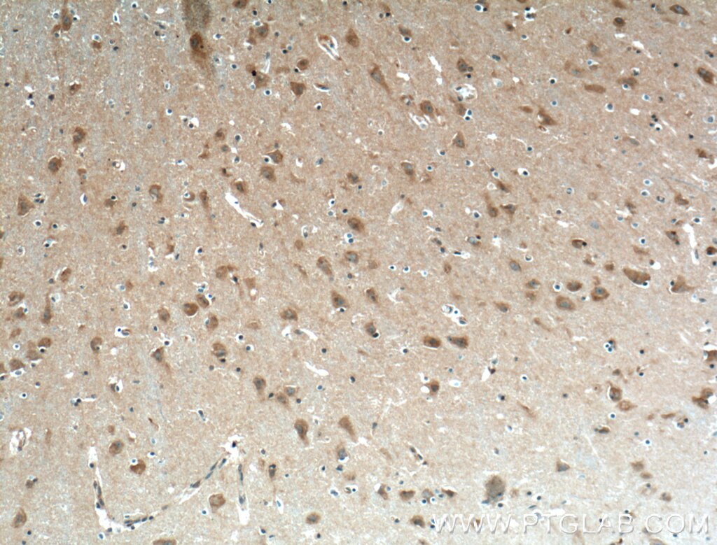 Immunohistochemistry (IHC) staining of human brain tissue using EHD3 Polyclonal antibody (25320-1-AP)