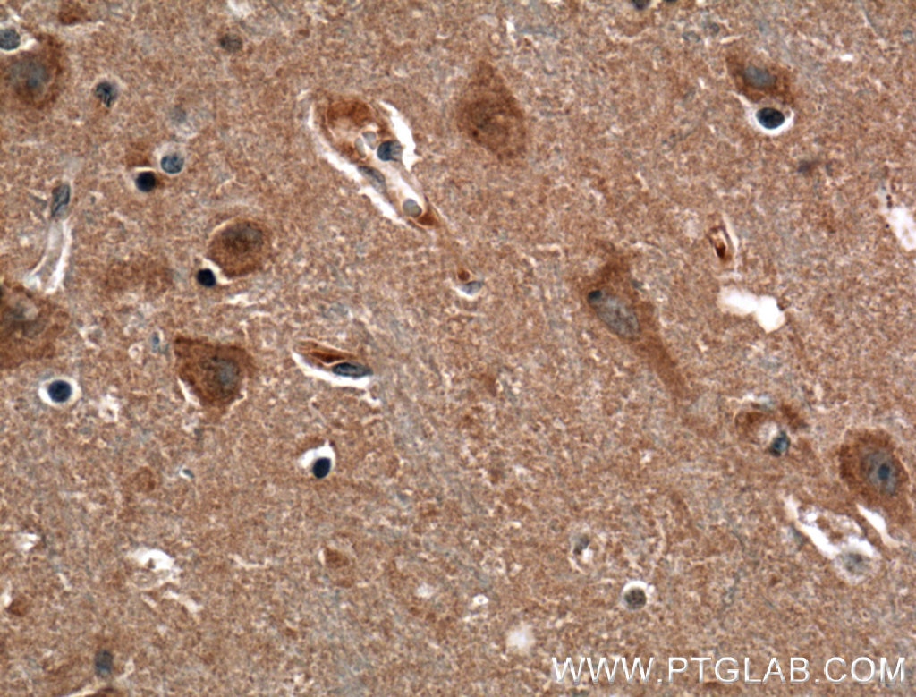 Immunohistochemistry (IHC) staining of human brain tissue using EHD3 Polyclonal antibody (25320-1-AP)
