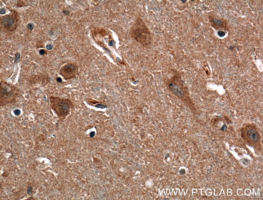 IHC staining of human brain using 25320-1-AP