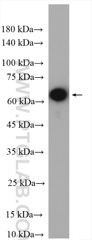 Western Blot (WB) analysis of human peripheral blood platelets using EHD3 Polyclonal antibody (25320-1-AP)