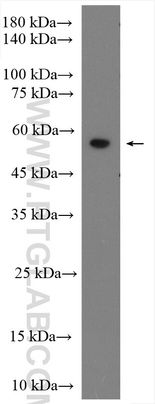 WB analysis of mouse kidney using 25320-1-AP