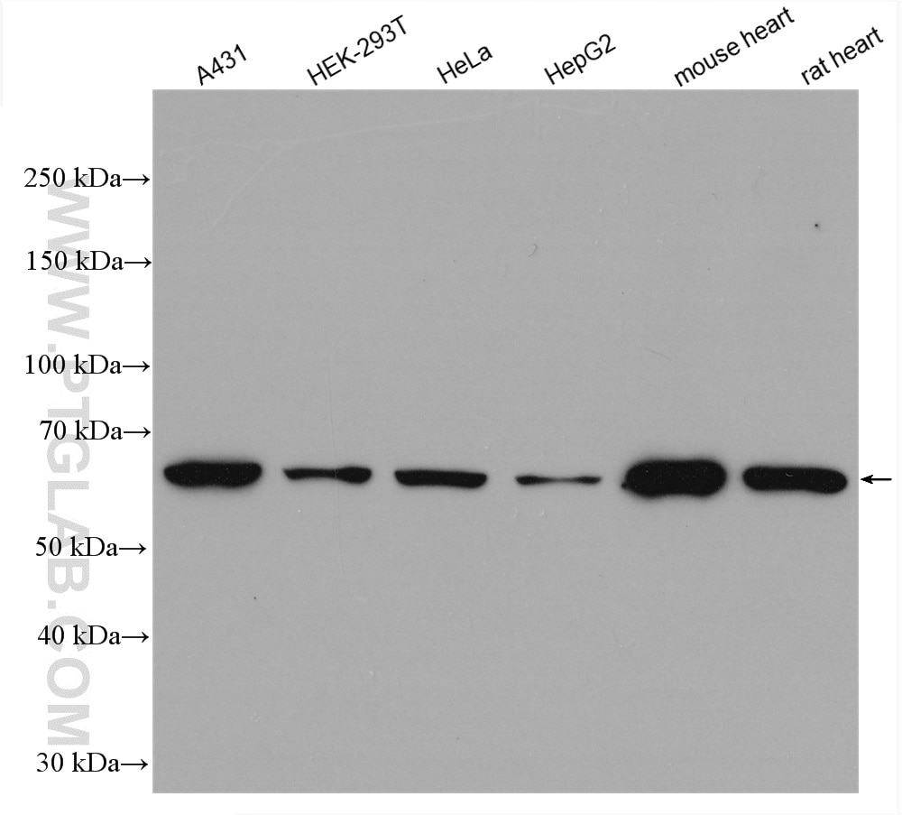 Western Blot (WB) analysis of various lysates using EHD4 Polyclonal antibody (11382-2-AP)