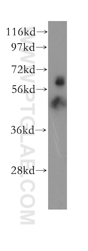 WB analysis of mouse testis using 11382-2-AP