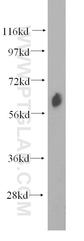 Western Blot (WB) analysis of HeLa cells using EHD4 Polyclonal antibody (11382-2-AP)