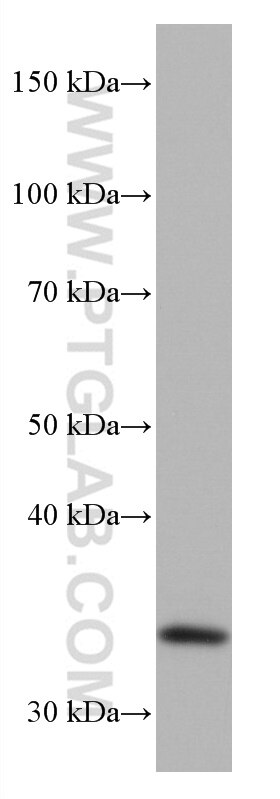 Western Blot (WB) analysis of LNCaP cells using EHF Monoclonal antibody (67125-1-Ig)