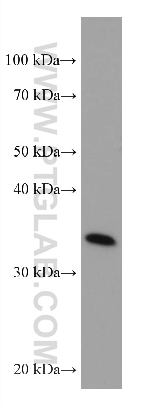 Western Blot (WB) analysis of human brain tissue using EHF Monoclonal antibody (67125-1-Ig)