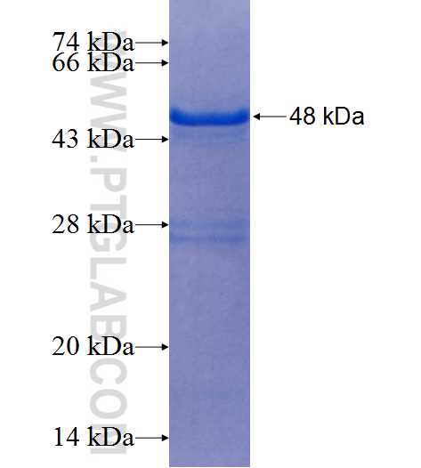 EHF fusion protein Ag25885 SDS-PAGE