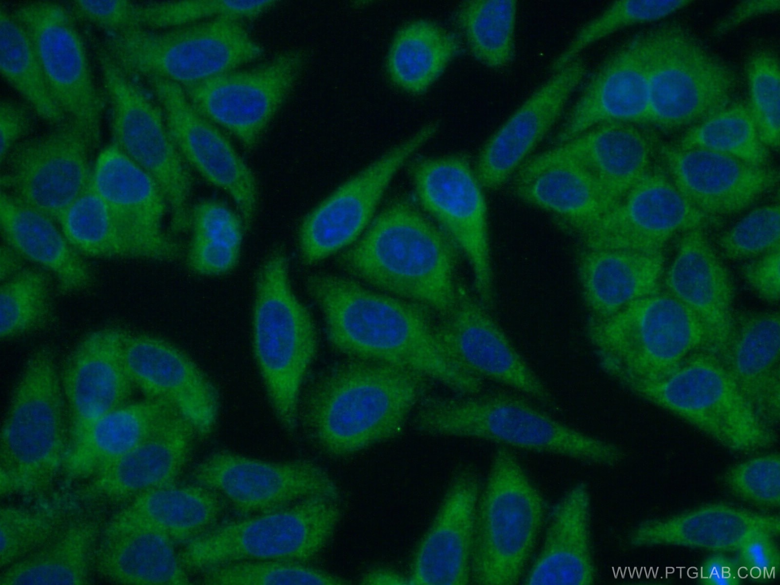 Immunofluorescence (IF) / fluorescent staining of HepG2 cells using EHHADH Polyclonal antibody (26570-1-AP)