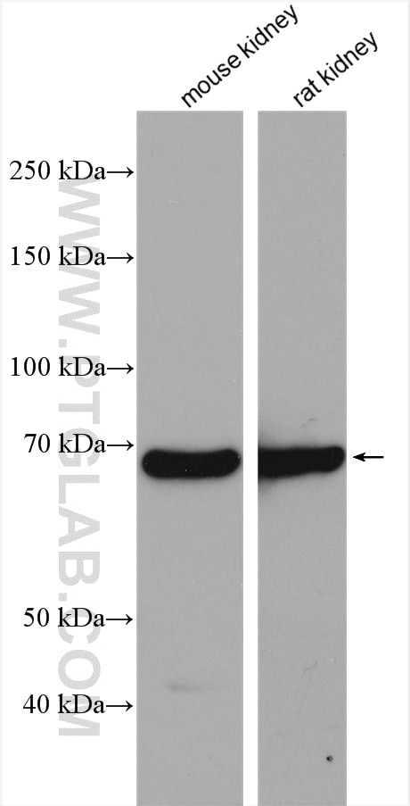 Western Blot (WB) analysis of various lysates using EHHADH Polyclonal antibody (26570-1-AP)