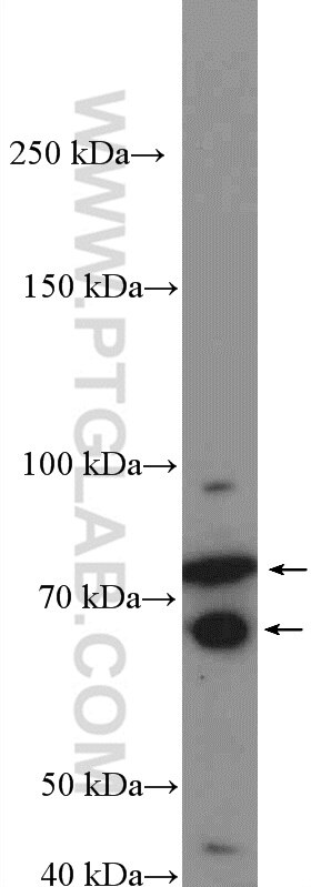 Western Blot (WB) analysis of SMMC-7721 cells using EHHADH Polyclonal antibody (26570-1-AP)