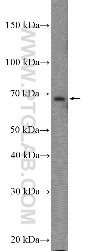 Western Blot (WB) analysis of HepG2 cells using EHHADH Polyclonal antibody (26570-1-AP)