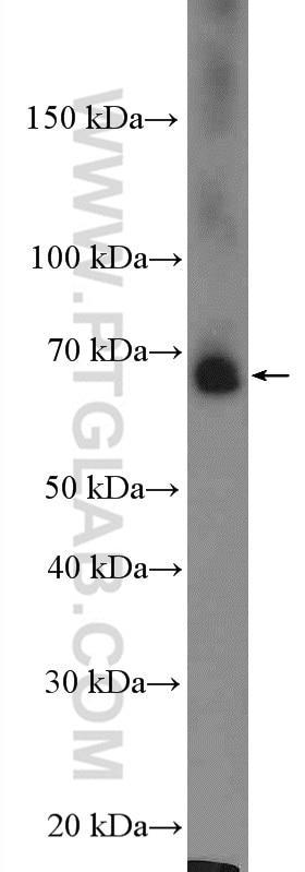 Western Blot (WB) analysis of mouse liver tissue using EHHADH Polyclonal antibody (26570-1-AP)