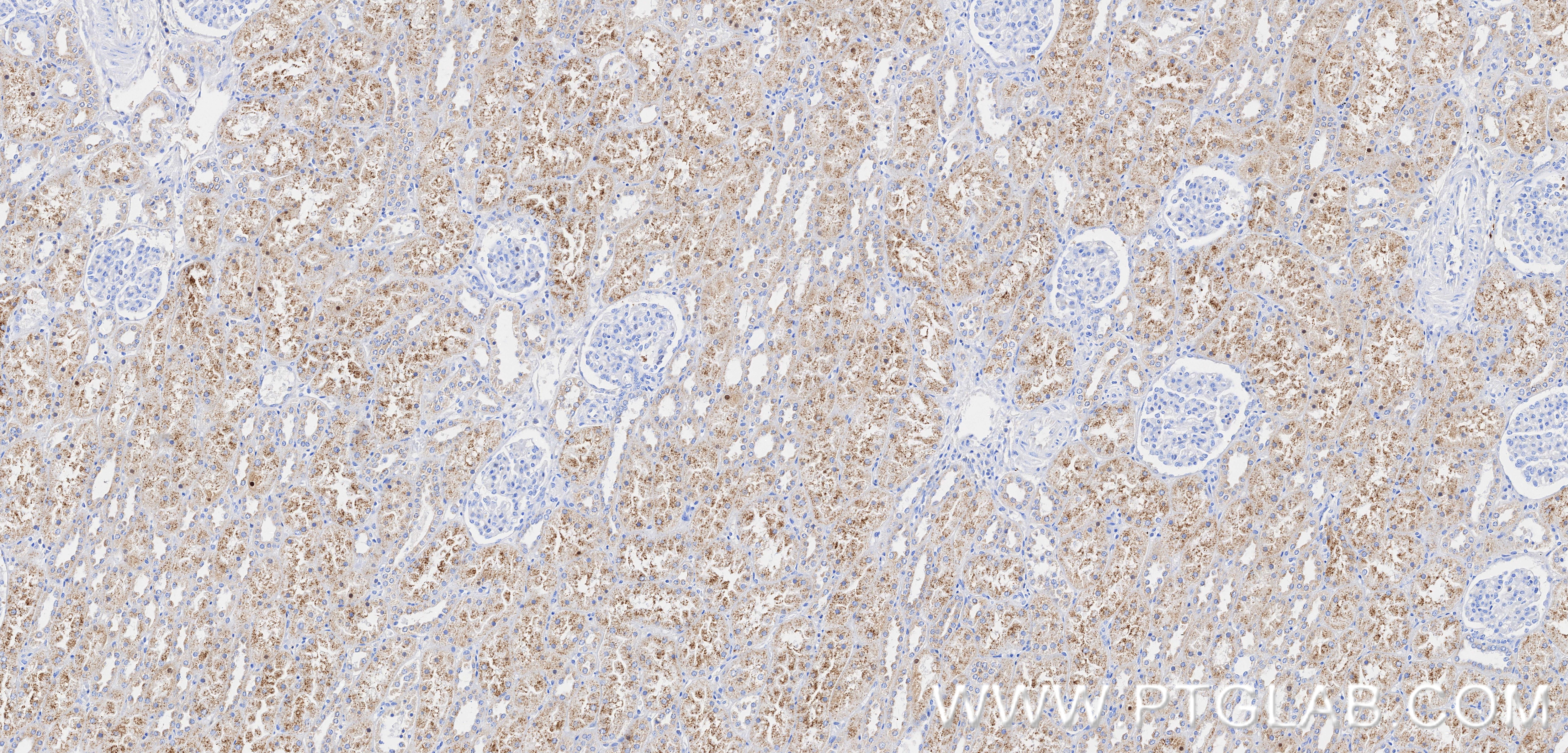 Immunohistochemical analysis of paraffin-embedded human kidney tissue slide using 87579-1-RR (EHHADH antibody) at dilution of 1:1000 (under 10x lens). Heat mediated antigen retrieval with Tris-EDTA buffer (pH 9.0). Immunohistochemistry (IHC) staining of human kidney tissue using EHHADH Recombinant monoclonal antibody (87579-1-RR)