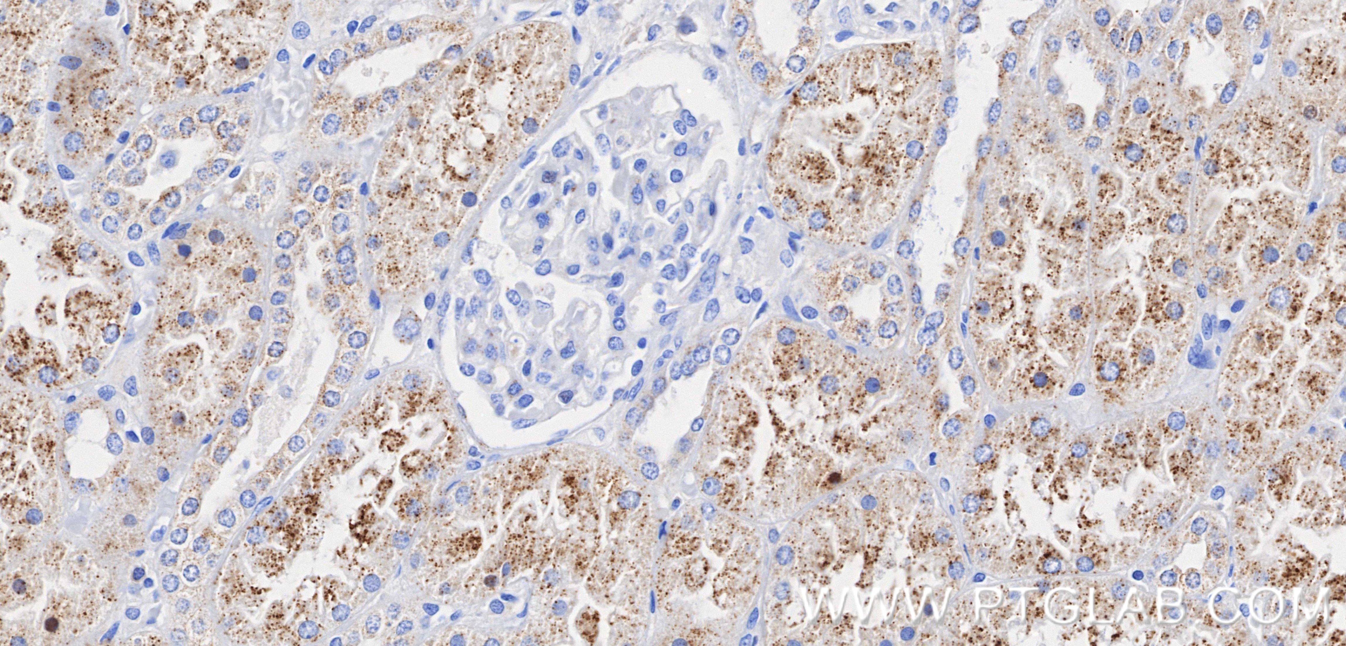 Immunohistochemical analysis of paraffin-embedded human kidney tissue slide using 87579-1-RR (EHHADH antibody) at dilution of 1:1000 (under 40x lens). Heat mediated antigen retrieval with Tris-EDTA buffer (pH 9.0). Immunohistochemistry (IHC) staining of human kidney tissue using EHHADH Recombinant monoclonal antibody (87579-1-RR)