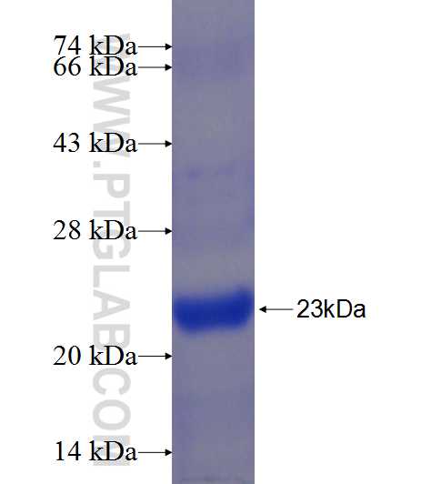 EHHADH fusion protein Ag24237 SDS-PAGE