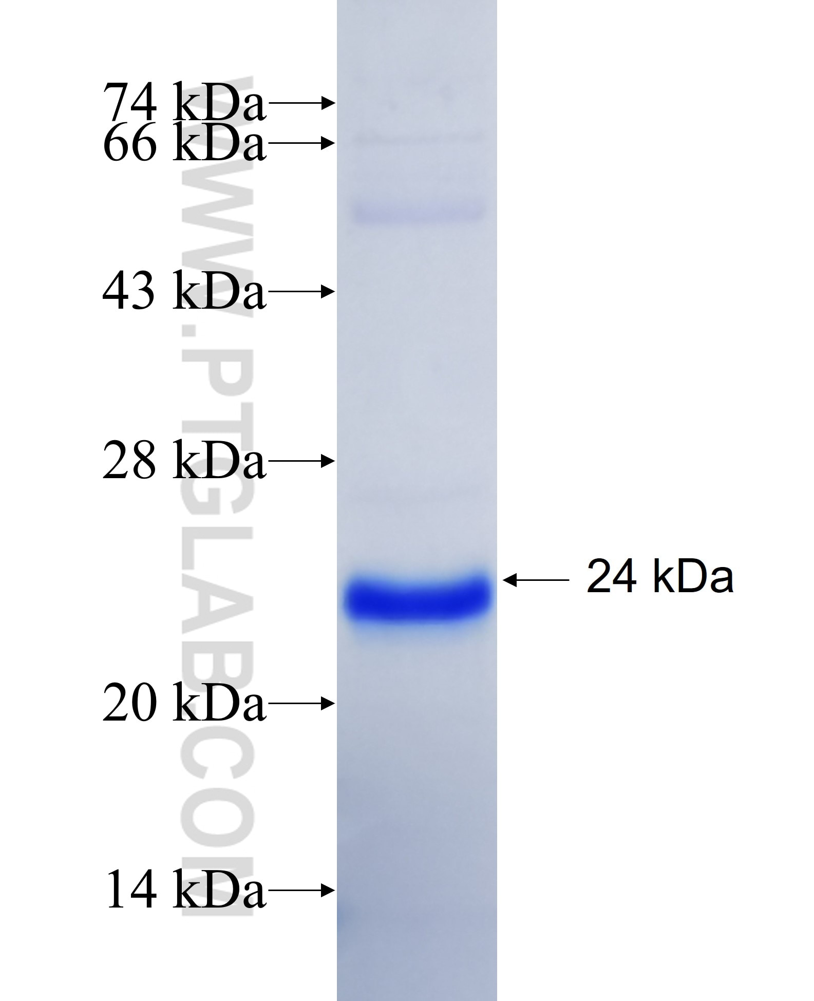 EHHADH fusion protein Ag24237 SDS-PAGE