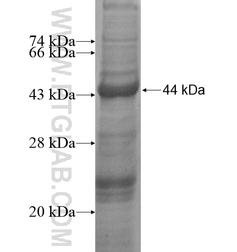 EHHADH fusion protein Ag15764 SDS-PAGE
