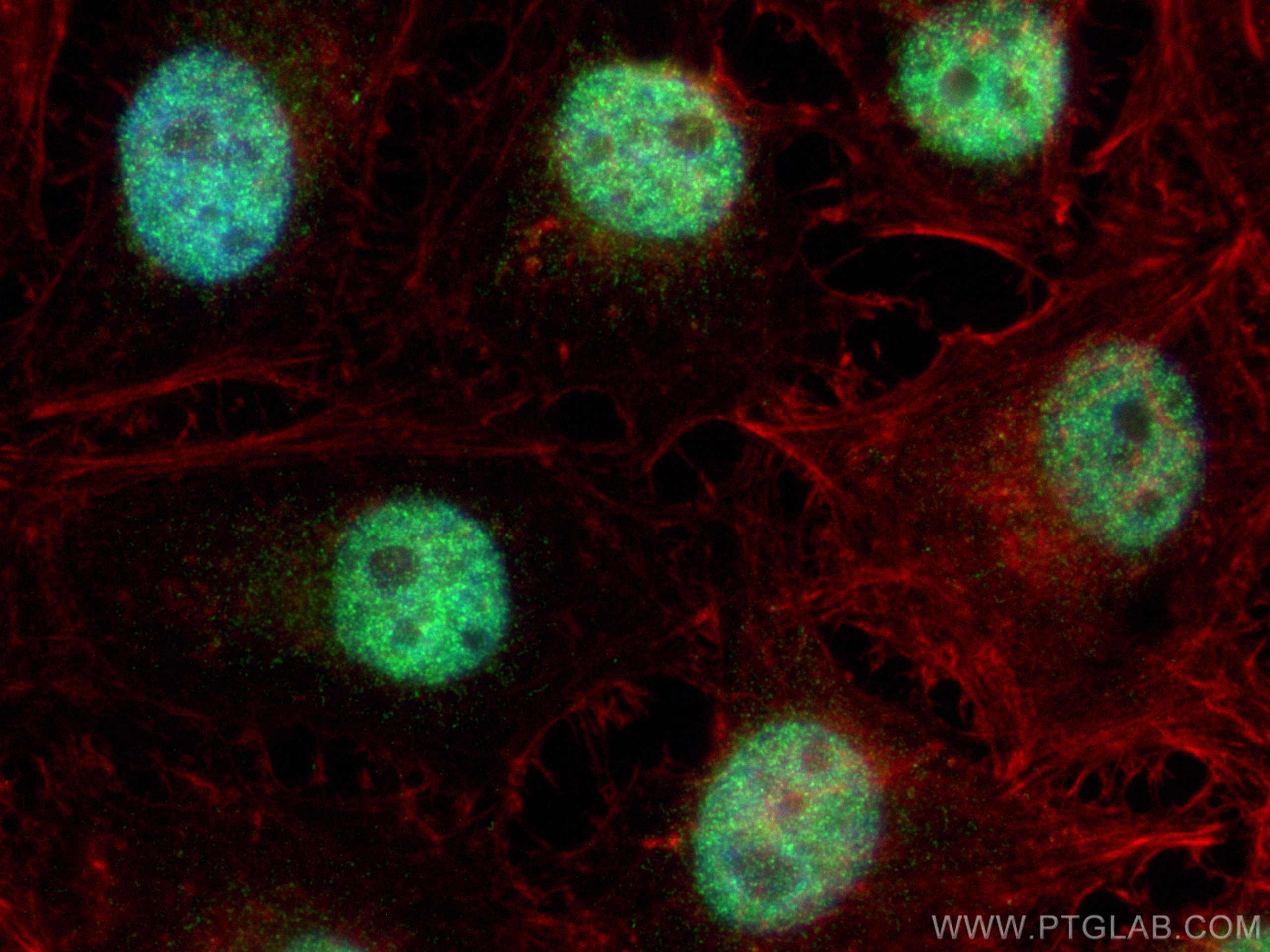Immunofluorescence (IF) / fluorescent staining of HeLa cells using EHMT1 Polyclonal antibody (55436-1-AP)