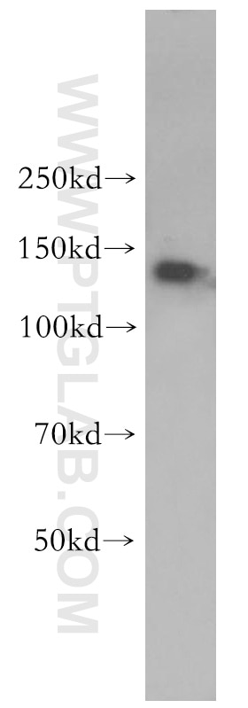 Western Blot (WB) analysis of Jurkat cells using EHMT2/G9a Polyclonal antibody (11595-1-AP)