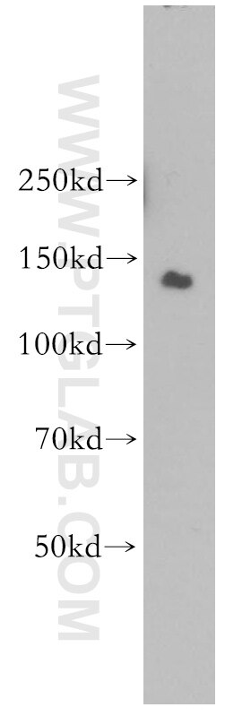 Western Blot (WB) analysis of HeLa cells using EHMT2/G9a Polyclonal antibody (11595-1-AP)