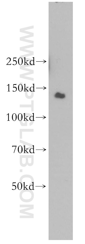 WB analysis of HeLa using 11595-1-AP