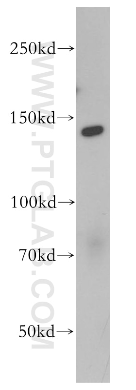 Western Blot (WB) analysis of Jurkat cells using EHMT2/G9a Polyclonal antibody (11595-1-AP)