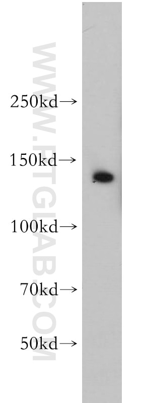 Western Blot (WB) analysis of HEK-293 cells using EHMT2/G9a Polyclonal antibody (11595-1-AP)