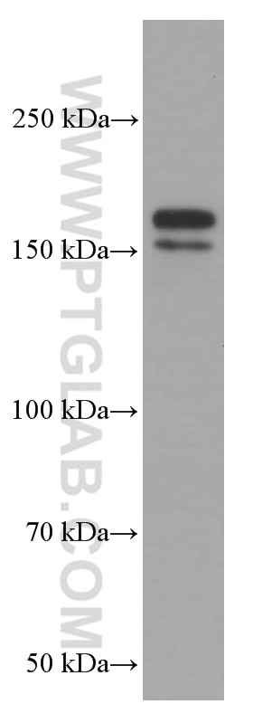 Western Blot (WB) analysis of HeLa cells using EHMT2 Monoclonal antibody (66689-1-Ig)