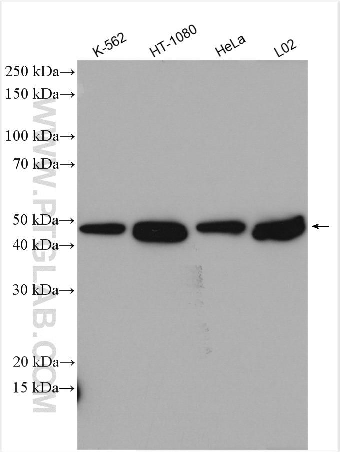 Western Blot (WB) analysis of various lysates using EI24 Polyclonal antibody (20456-1-AP)