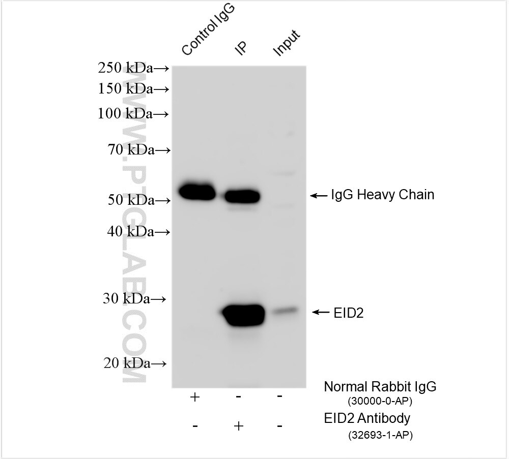 IP experiment of HEK-293 using 32693-1-AP Immunoprecipitation (IP) experiment of HEK-293 cells using EID2 Polyclonal antibody (32693-1-AP)