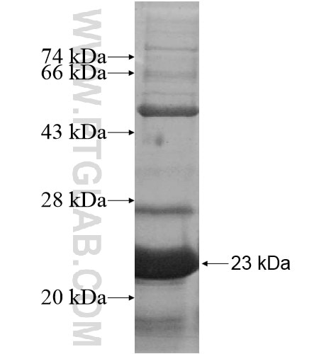 EID2B fusion protein Ag11480 SDS-PAGE