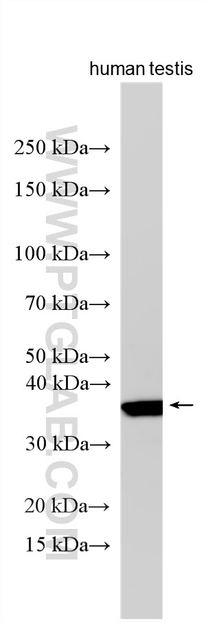 WB analysis using 17241-1-AP Western Blot (WB) analysis of various lysates using EID3 Polyclonal antibody (17241-1-AP)