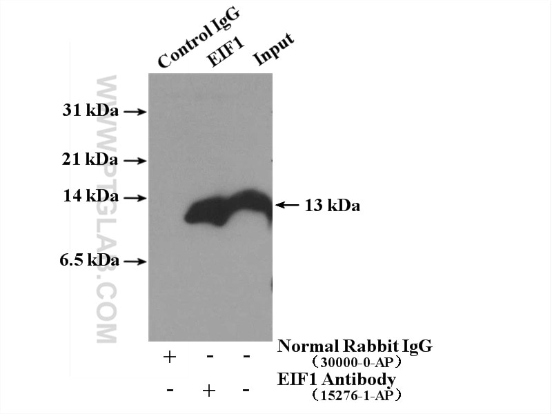 Immunoprecipitation (IP) experiment of Jurkat cells using EIF1 Polyclonal antibody (15276-1-AP)