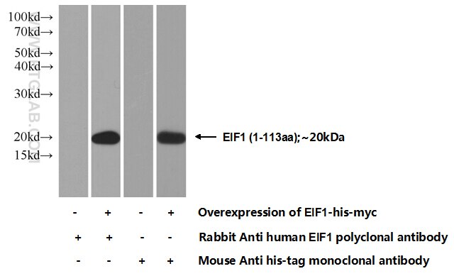 EIF1