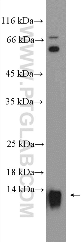 Western Blot (WB) analysis of Jurkat cells using EIF1 Polyclonal antibody (15276-1-AP)