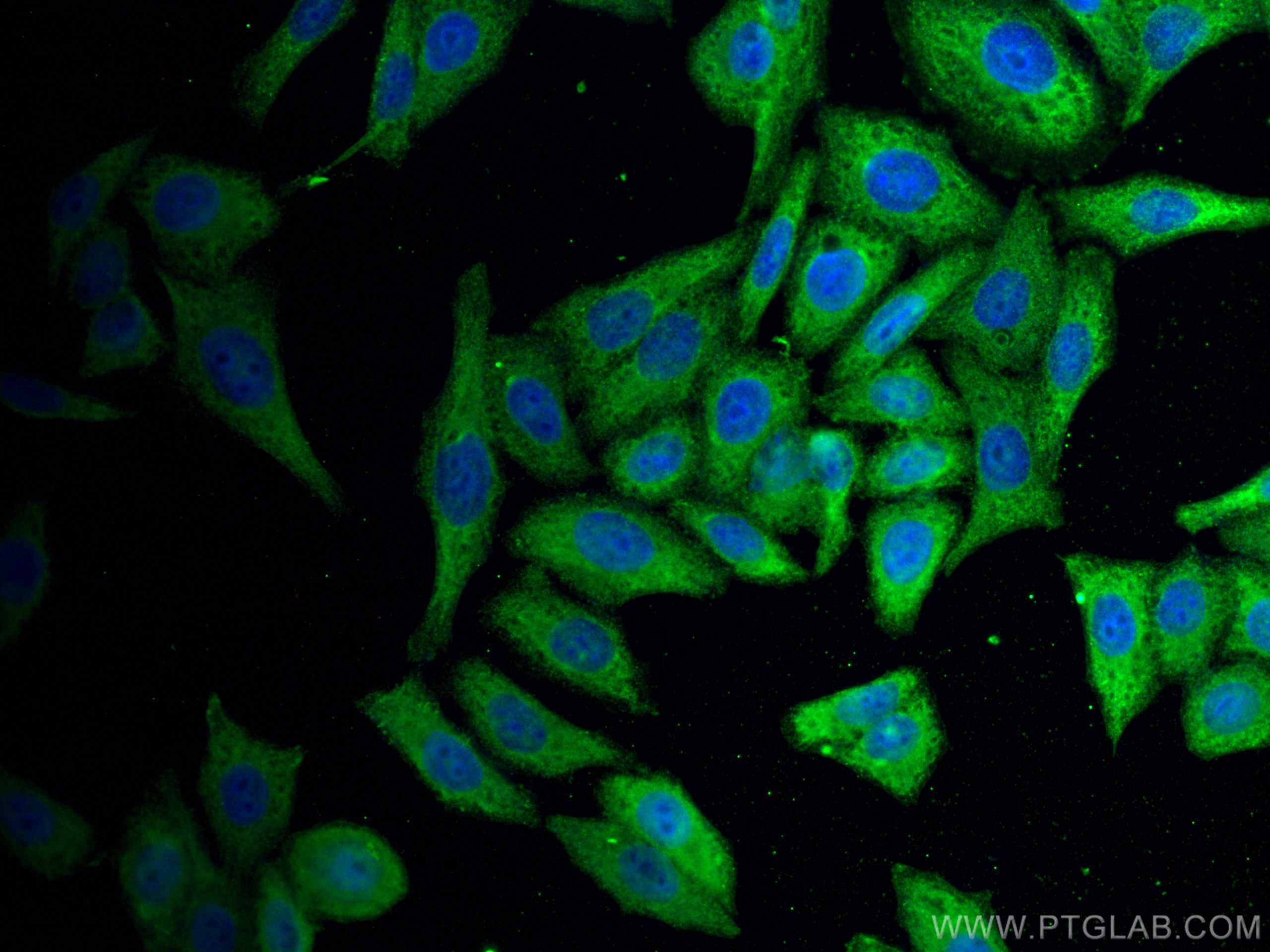 Immunofluorescence (IF) / fluorescent staining of HepG2 cells using EIF1 Monoclonal antibody (67601-1-Ig)