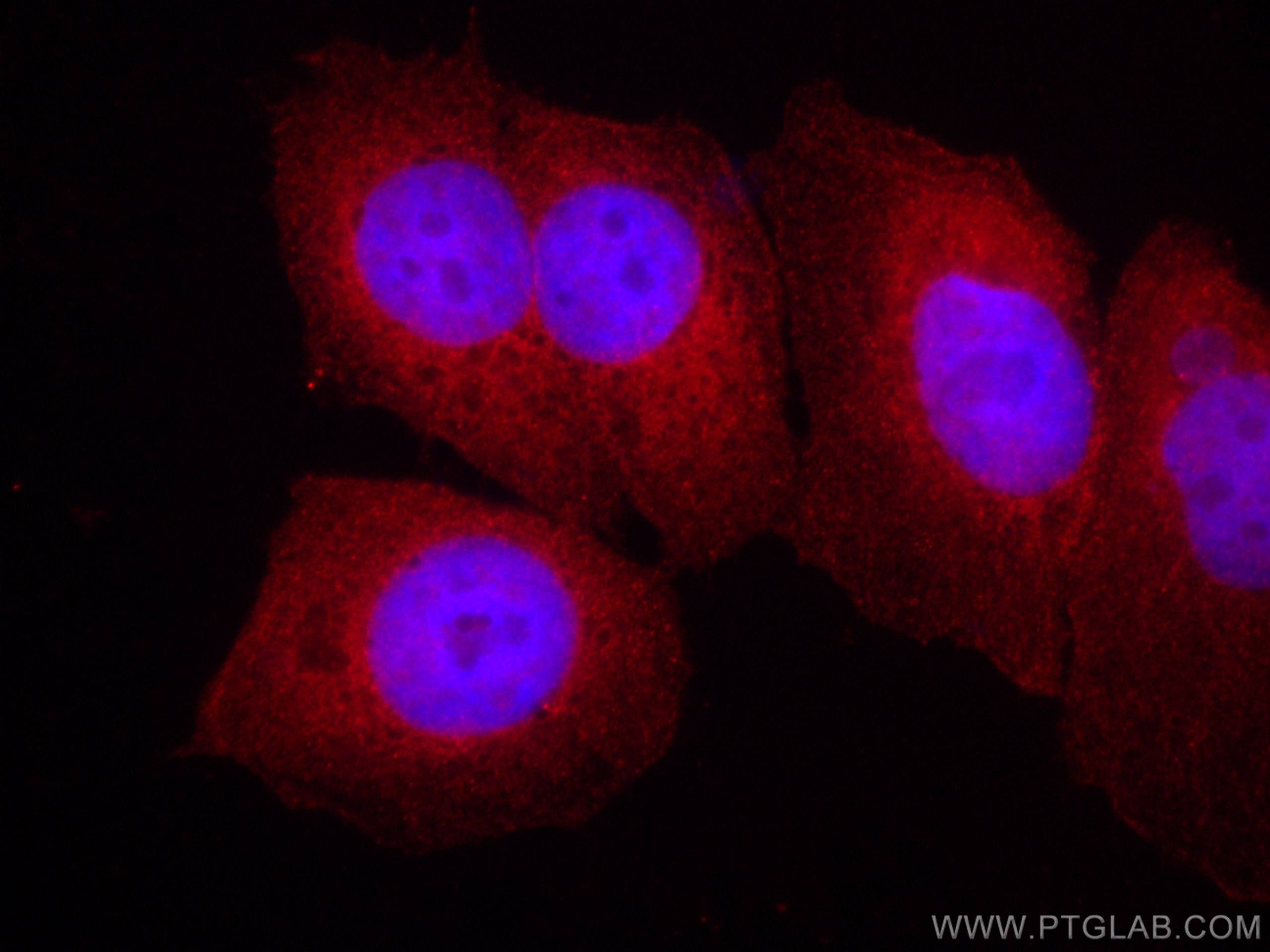 Immunofluorescence (IF) / fluorescent staining of MCF-7 cells using CoraLite®594-conjugated EIF1 Monoclonal antibody (CL594-67601)