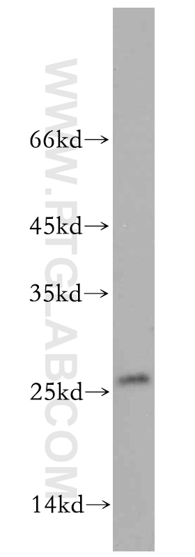 Western Blot (WB) analysis of MCF-7 cells using EIF1AD Polyclonal antibody (20528-1-AP)