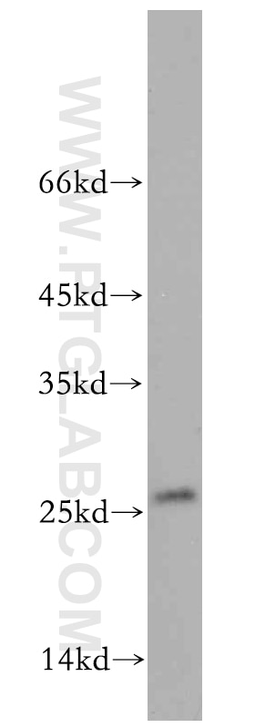 Western Blot (WB) analysis of MCF-7 cells using EIF1AD Polyclonal antibody (20528-1-AP)