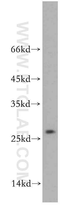 Western Blot (WB) analysis of K-562 cells using EIF1AD Polyclonal antibody (20528-1-AP)