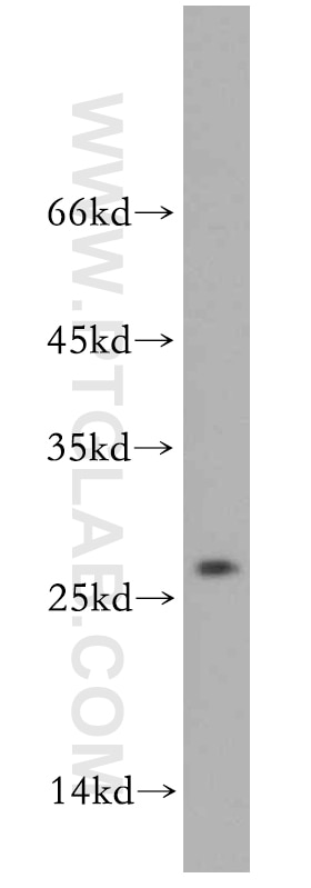 WB analysis of K-562 using 20528-1-AP