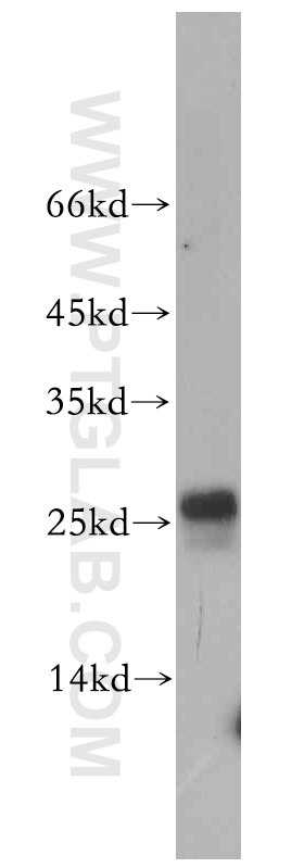Western Blot (WB) analysis of HL-60 cells using EIF1AD Polyclonal antibody (20528-1-AP)
